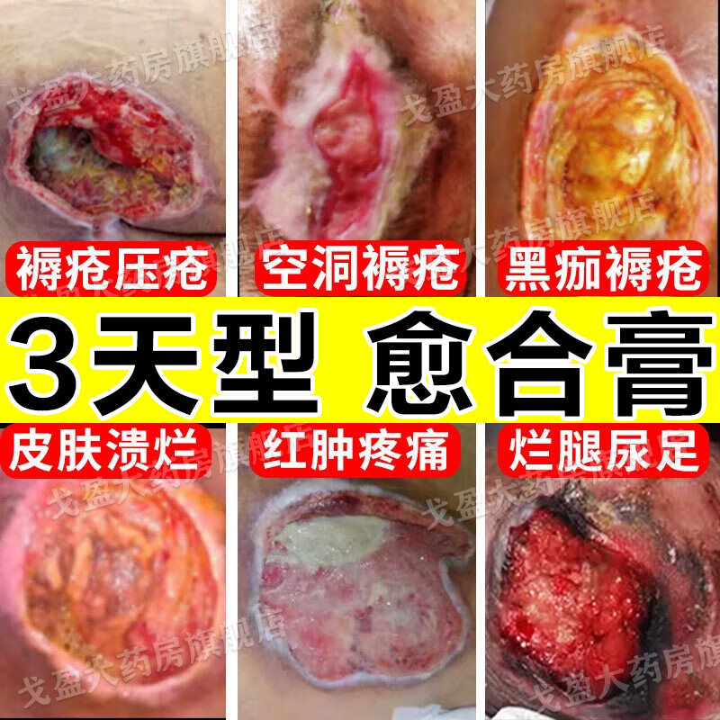 【马应龙】龙珠软膏10g*1支/盒