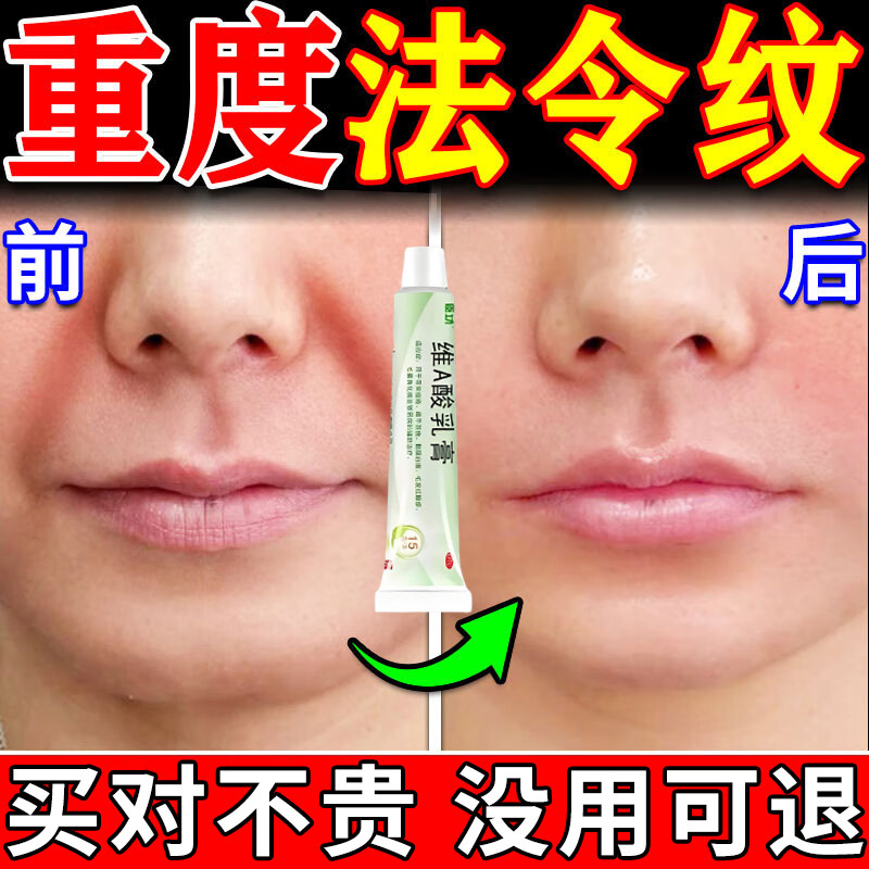维A酸乳膏法令纹男士专用川子纹抬头纹鱼尾纹消正品除神器官方店