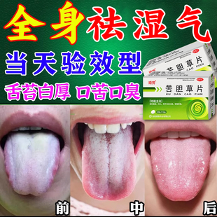 身体湿气太重吃什么药祛看湿排毒排体内湿寒减肥肚子大舌苔厚齿痕