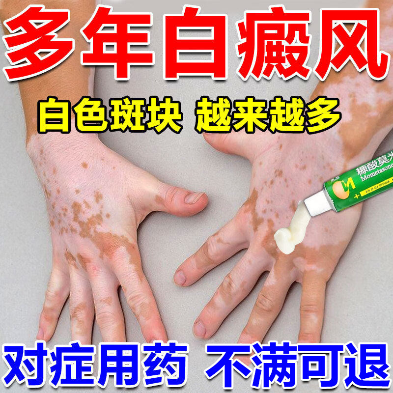白癜风特药效快治消速白斑专用白癜风药膏促进黑素糠酸莫米松乳膏