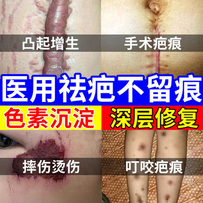祛疤凝胶修复除疤膏疤痕增生凸起去除疙瘩疤印淡化黑色素