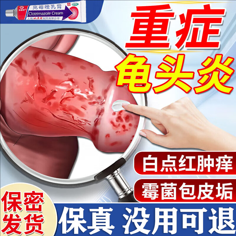 克霉唑乳膏男性官方旗舰店龟头炎专用药膏真菌感染包皮炎特新效期