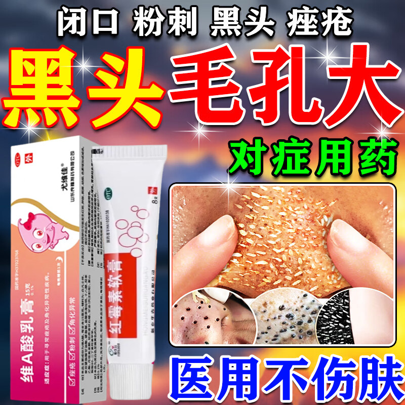 异维a酸红霉素软膏去黑头收缩毛孔粗大粉刺深层清洁闭口痤疮痘印
