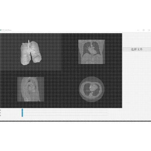 CT三维重建 CT分割 滤波 医学图像的可视化 PyQt 支持JPG PNG TIF