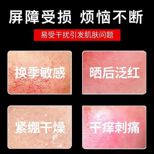 修正敏感装肌修覆护脸部DTE泛红改水套去红血丝善皮肤屏障角质乳