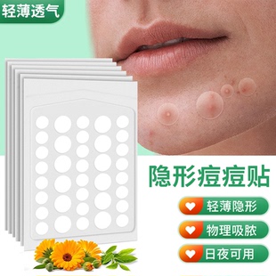 痘痘贴隐形痘痘贴医用祛痘贴膏去痘印痘坑修复淡化隐形贴轻薄透气