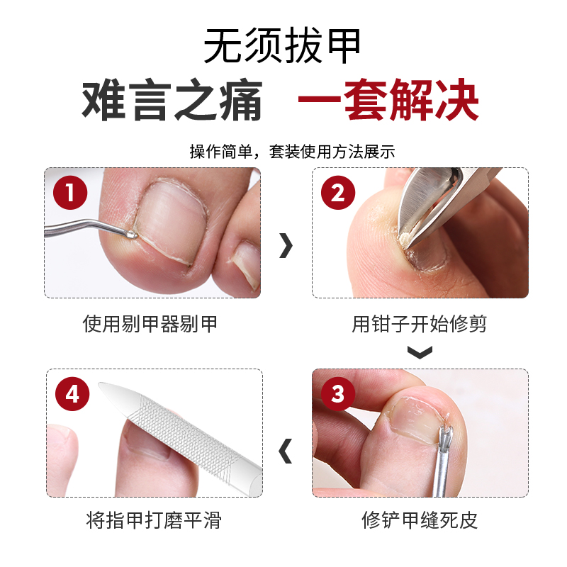 甲沟指甲剪刀单个修脚鹰嘴修脚趾甲神器剪指夹沟鹰嘴钳套装炎