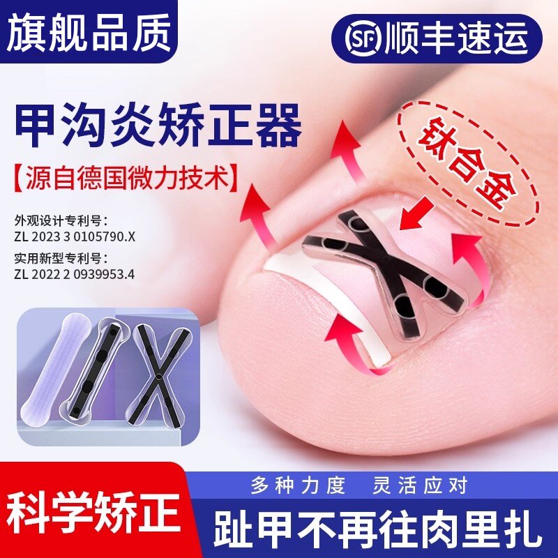 德国医用脚趾甲沟嵌甲炎矫正器