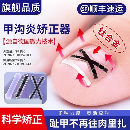 德国医用脚趾甲沟嵌甲炎专用矫正器正甲贴片修剪指甲刀往肉里长