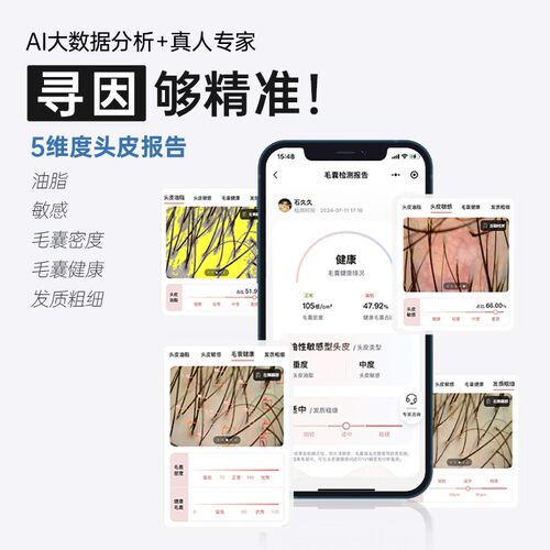 MYAI【年终爆品日】智能密发仪红光梳生密发仪健发梳健发仪防脱
