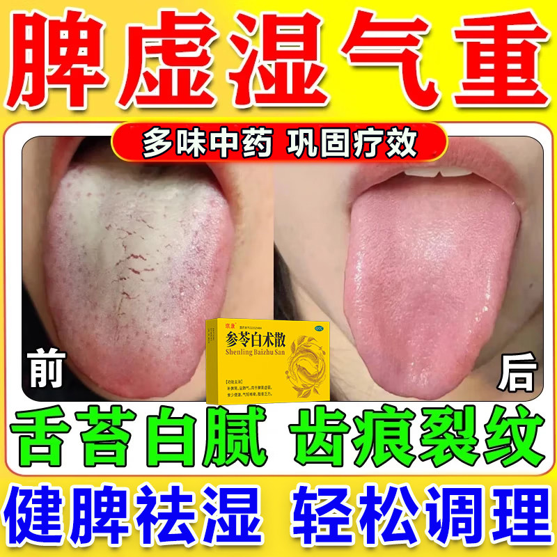 参苓白术散中药健脾祛湿舌苔白厚口臭舌头有齿痕脾虚调理湿气太重