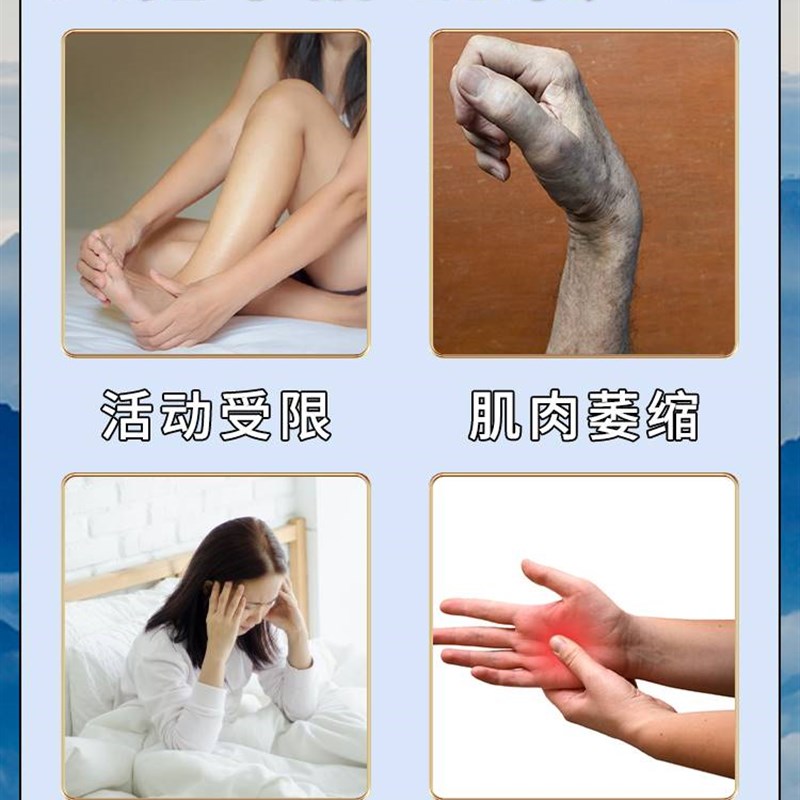 腕管综合症手麻腕管综合t症手麻治手麻四肢麻木的膏药贴腕管综