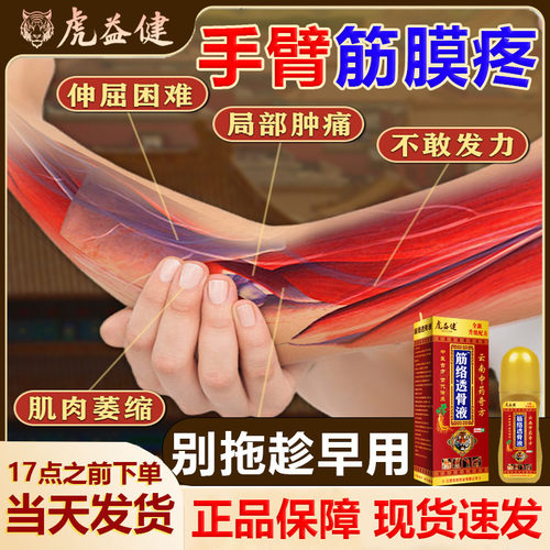 虎益健手臂筋膜炎透骨液！早用好