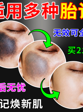 胎记非去除神器非祛天生胎咖啡斑非分解淡化黑色素沉淀太田痣精油