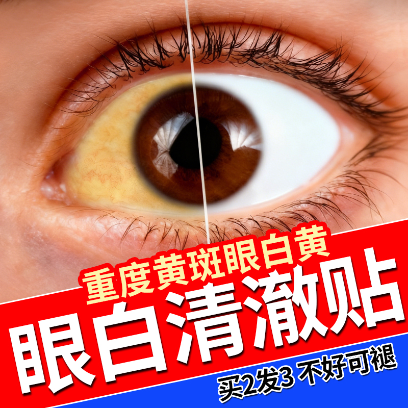 眼白清澈去黄滴眼液眼白发黄非眼药水修复发黄眼睛浑浊黄斑病变
