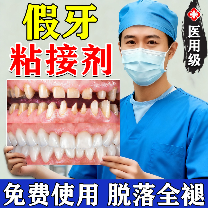 粘烤瓷牙专用胶牙冠粘合剂牙套脱落假牙崩瓷修复专用粘接剂修补膏