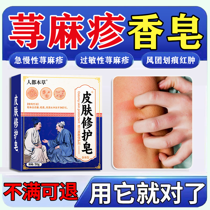 荨麻疹专用皂治疗皮肤瘙痒过敏提升免疫力浮萍丘疹性荨麻疹沐浴皂