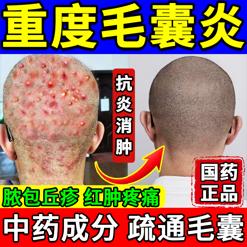 【双龙】蒲地蓝消炎片0.31g*48片/盒