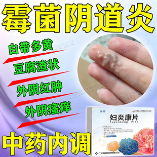 妇科炎症专用药正品盆腔口服消专治反复霉菌性阴道炎白带多豆腐渣