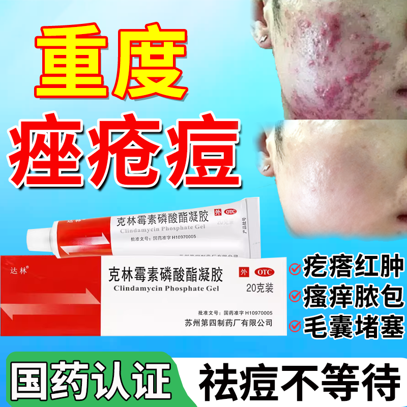 【达林】克林霉素磷酸酯凝胶1%*20g*1支/盒