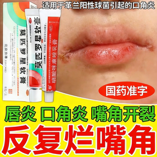口角炎嘴巴上火起泡烂嘴唇角疱疹唇炎专用唇药膏儿童嘴唇干裂脱皮