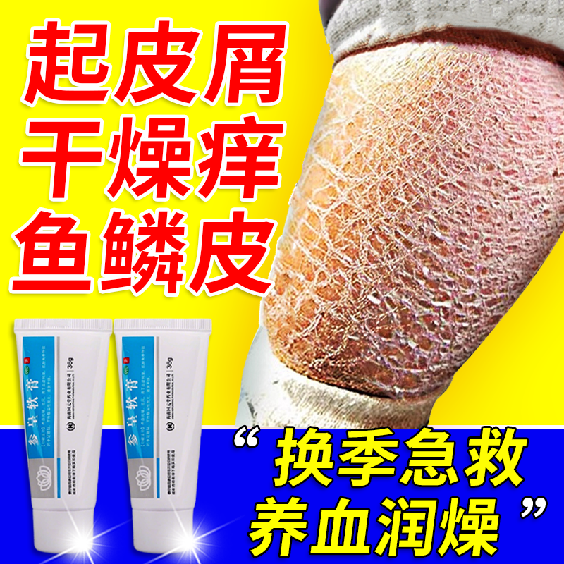 参皇软膏冬天换季腿痒小腿皮肤干燥起皮鱼鳞皮瘙痒掉皮屑止痒膏,OTC药品/国际医药,抗菌消炎,淘宝优惠券,粉丝福利购,淘宝优惠卷