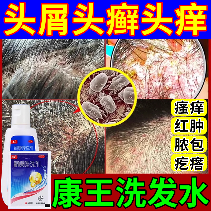 【康王】酮康唑洗剂2%*50ml*1瓶/盒