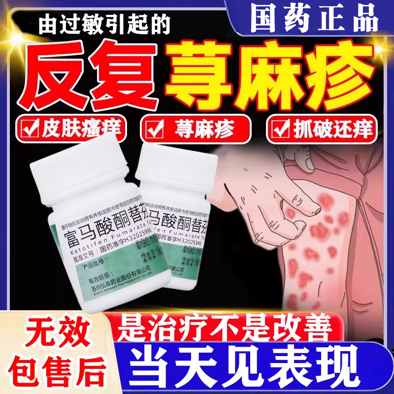 富马酸酮替芬片寻荨麻疹过敏止痒断痒根专用治疗荨麻疹的特痒效药