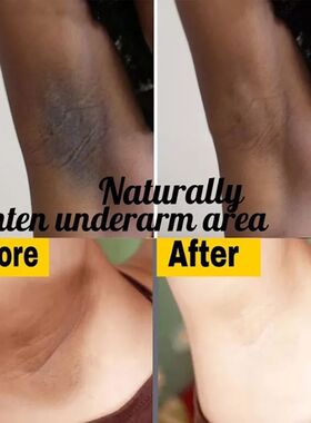 极速Inatimate Area Pink Essence Underarm Inner Thigh Ankle E