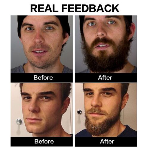 极速Beard Growtkh Oil for Men Quick Absorption Moisturize Be