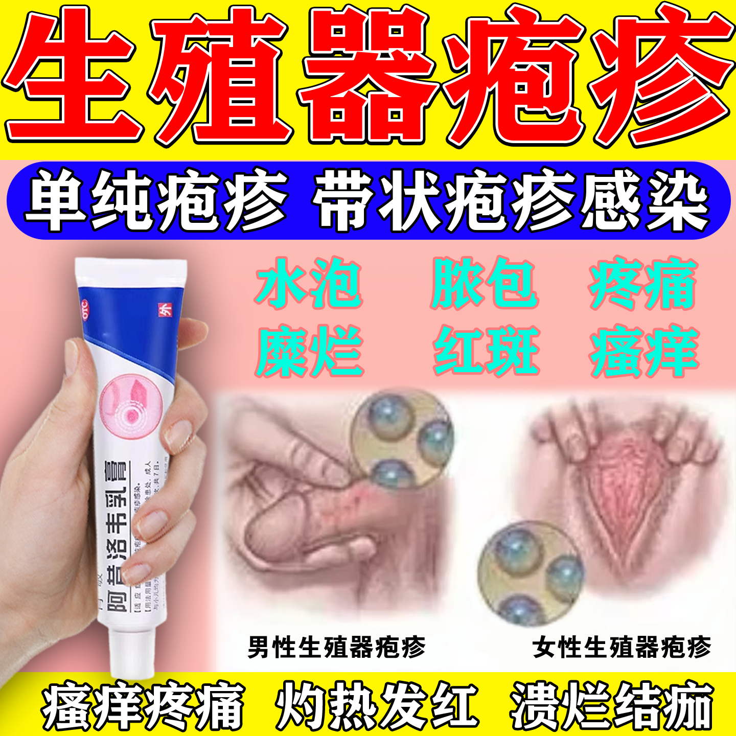 阿昔洛韦乳膏抗病毒疱疹皮肤感染水泡梅毒红疹生殖疱疹水痘外用药