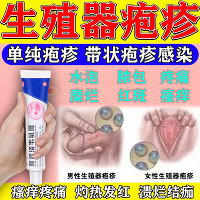 阿昔洛韦乳膏抗病毒疱疹皮肤感染水泡梅毒红疹生殖疱疹水痘外用药