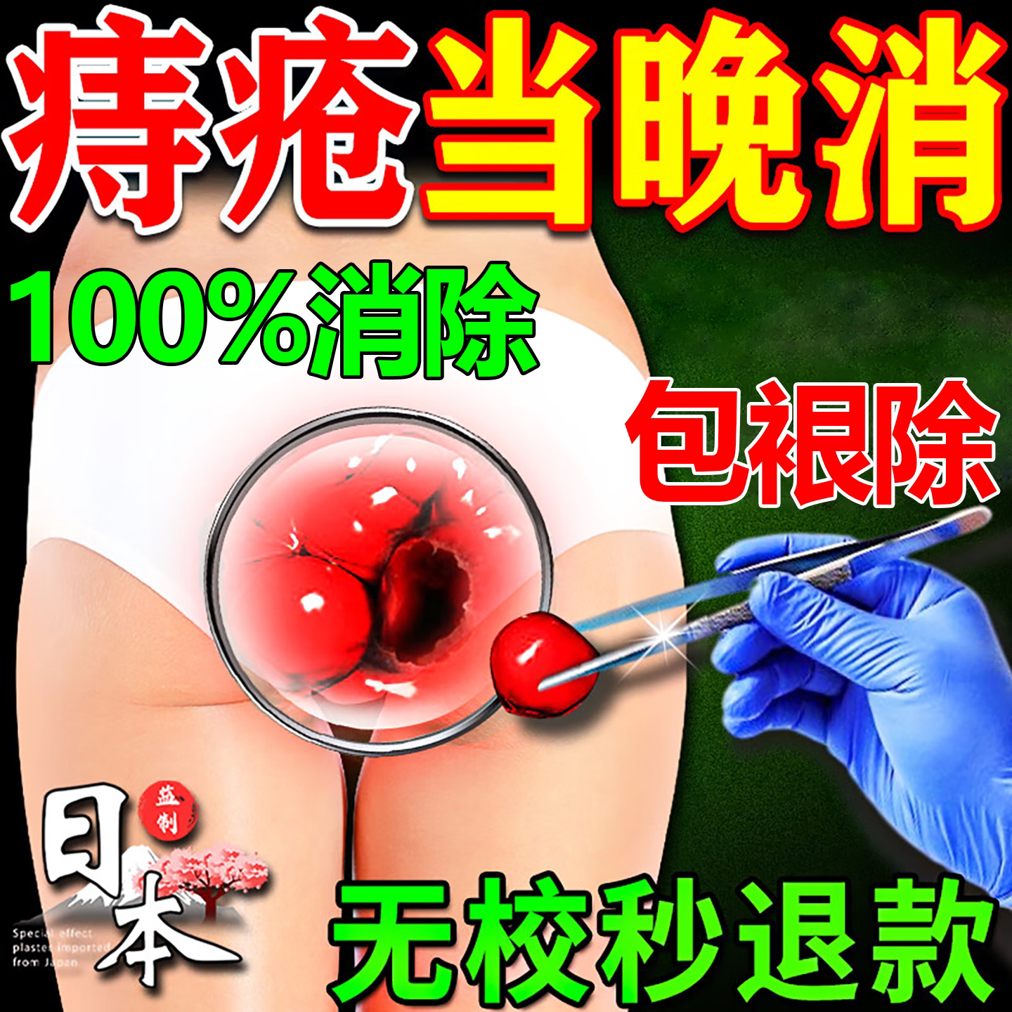 日本痔痣疮膏药排行榜第一名消肉球女性内痔外痔混合痔效特药凝胶