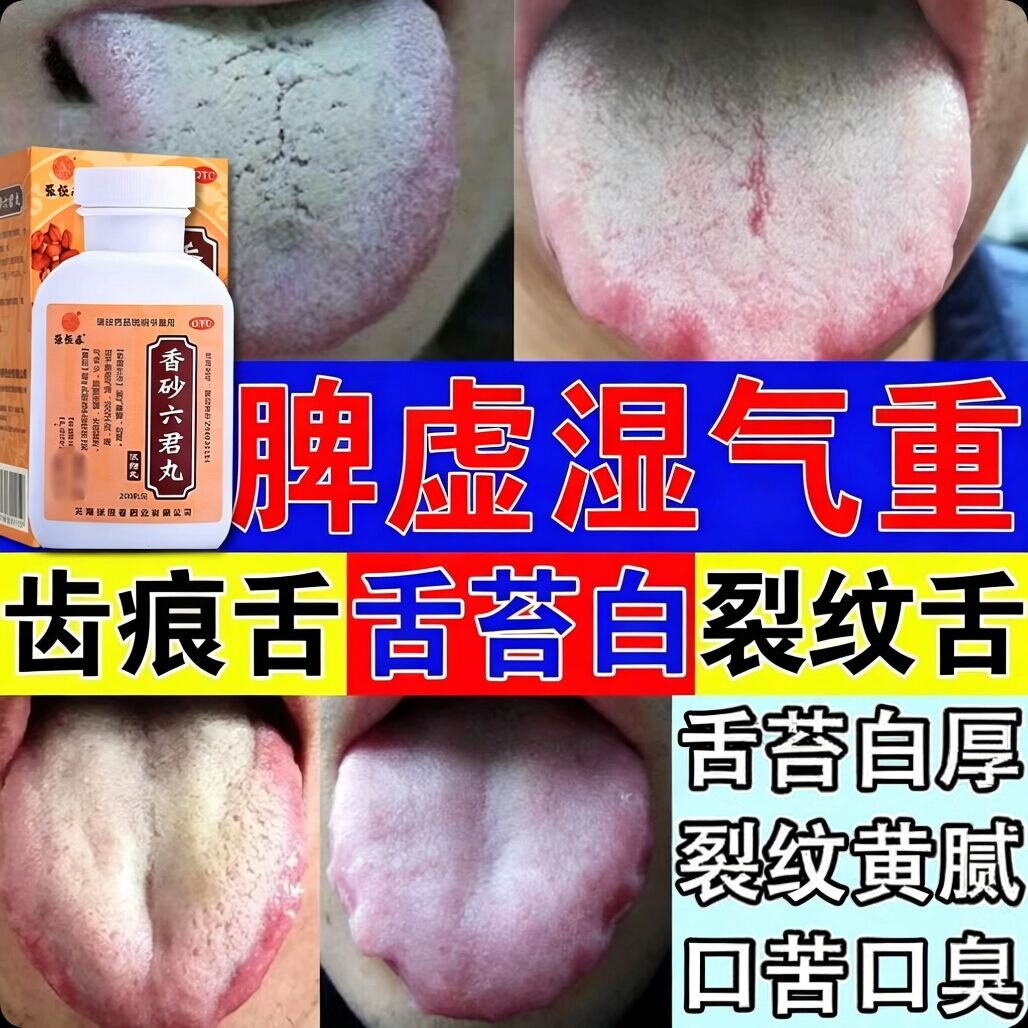 香砂六君丸正品舌苔白厚舌头裂纹有齿痕祛湿健脾养胃调理湿气重药