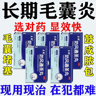 毛囊炎口服药清热解毒治头皮痒后背红肿长疙瘩痘痘脓包毛囊堵塞S