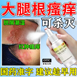 大腿内侧皮肤瘙痒股藓止痒喷雾 男士私处真菌感染湿疹潮湿瘙痒G