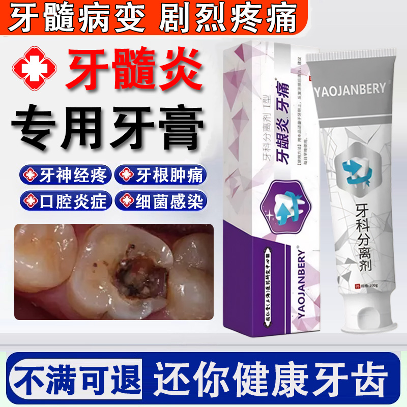 牙疼药快速止痛牙神经疼