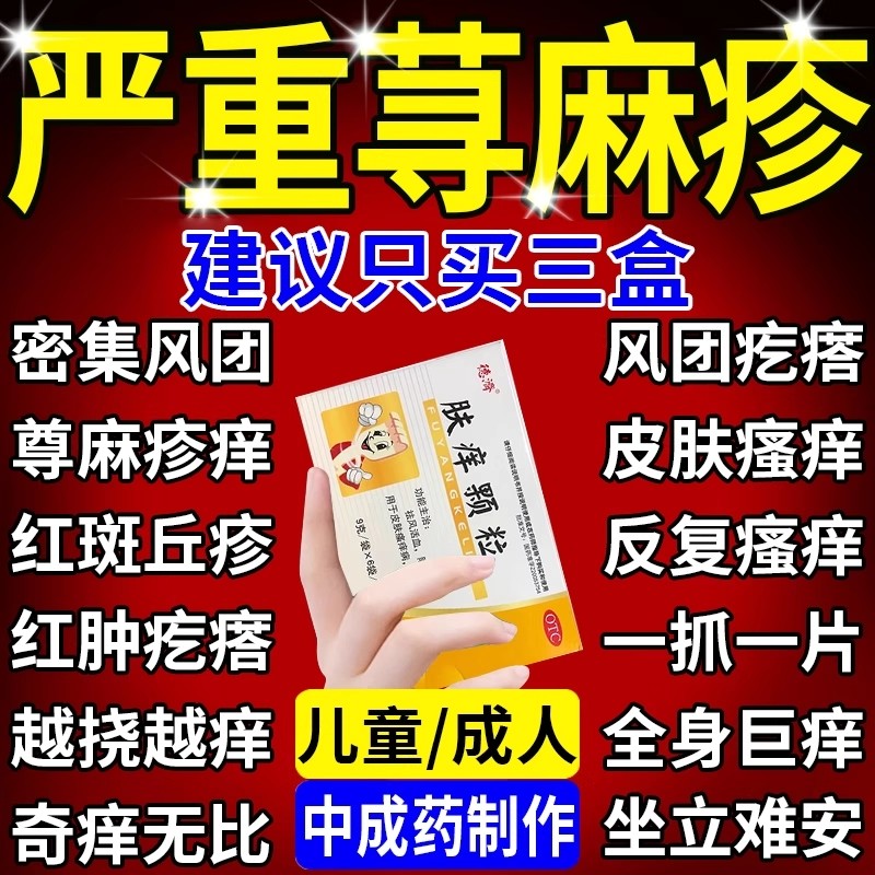 皮肤痒止痒颗粒正品官方旗舰店治疗荨麻疹非特效中成药成人荆