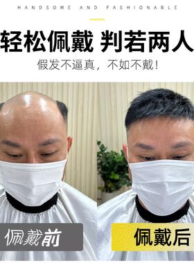 假发男士短发毛寸头顶补发块全真人发自然无痕薄款夏季男生假发片