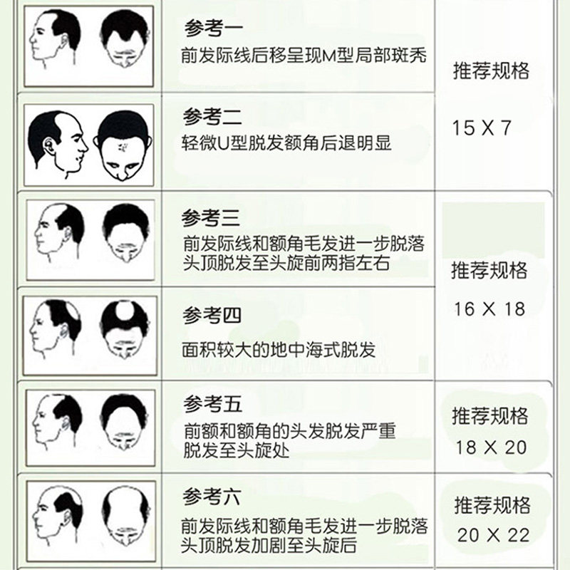 织发补发假发男士头顶短发块真发假发片秃顶无痕隐形前额地中海