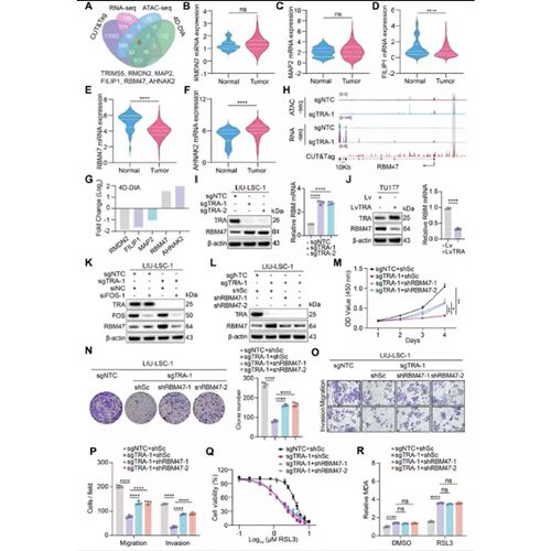 lncRNA调控网络高质量服务miRNA-lncRNA-mRNA网络图SCI作图支持