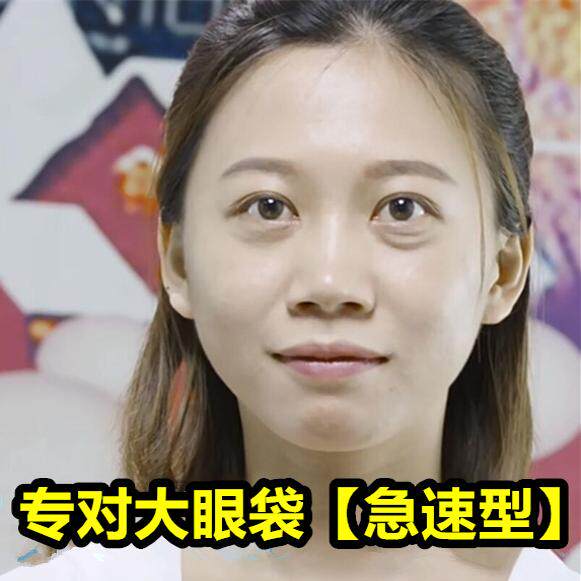一夜美【专对大眼袋】韩国一夜美男女紧致眼霜淡化黑眼圈大眼袋贴