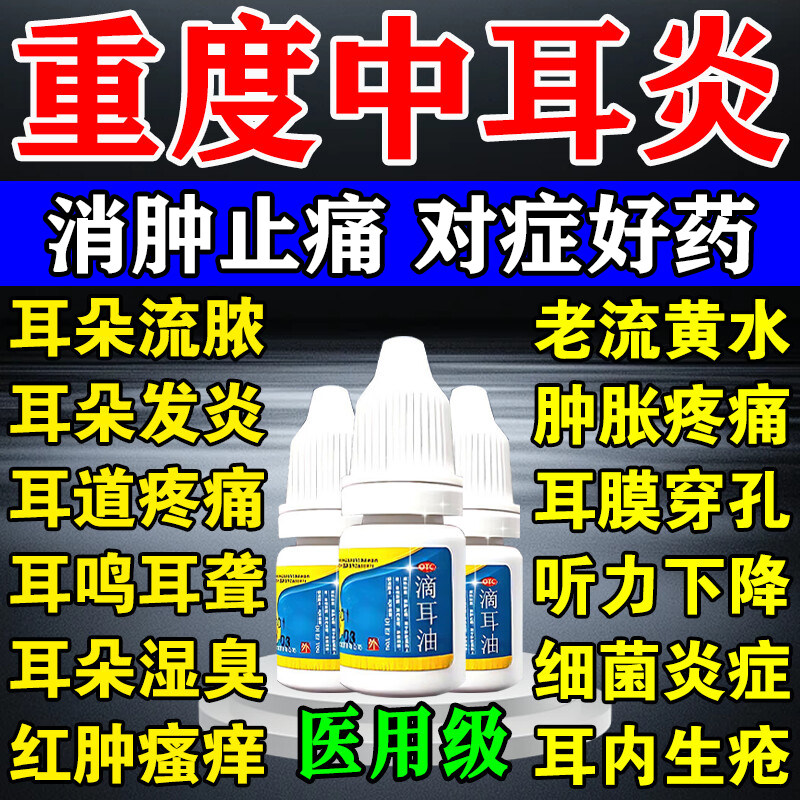 中耳炎特疼效药可除耳根滴耳液耳朵消炎耳朵痒流脓流水滴耳油