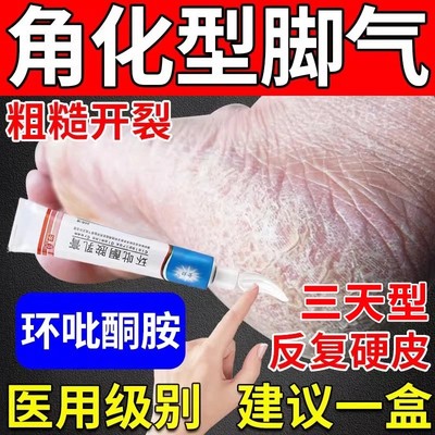 环吡酮胺乳膏抗真菌官方旗舰店脚后跟干裂起硬皮足跟开裂脚气药膏