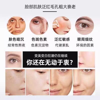 黑金超光子嫩肤仪器美白美容专用仪器牛奶光提拉紧致抗衰美容仪器