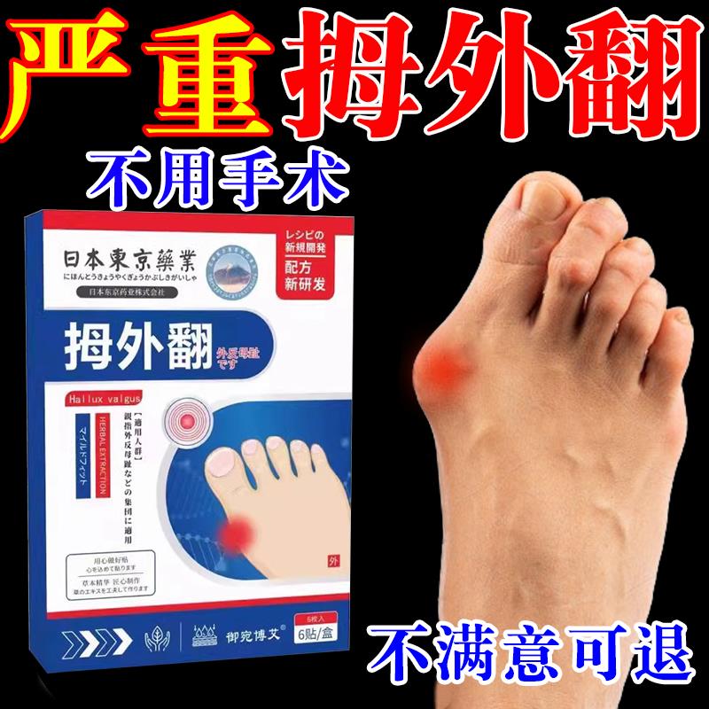 拇指外翻矫正器脚趾重叠大脚骨外翻脚趾疼痛畸形肿胀矫正专用贴药
