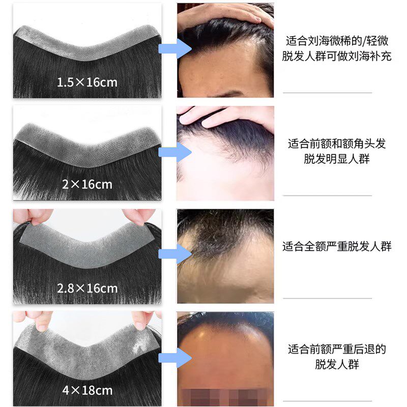 假发男士男前额补发片发际线假发贴轻薄透气隐形前额三七分刘海片