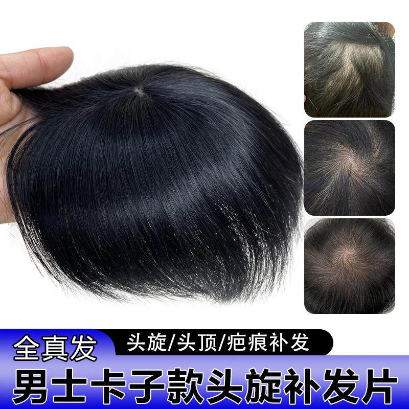假发片男全真发头顶头旋发缝疤痕补发片递针旋遮斑秃脱发男士假发
