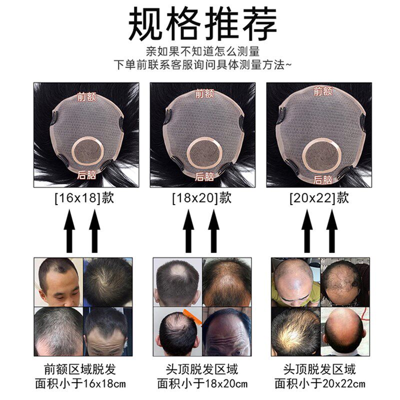 假发男短发头顶补发片无痕隐形真发光头秃顶帅气超薄短发男士补发