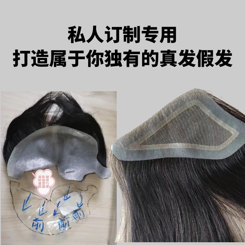 假发发型定制真发光头补发女无痕隐形补发发际线男士头顶假补发块